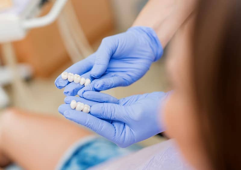 Dental Restorations in Aspen, SW Calgary