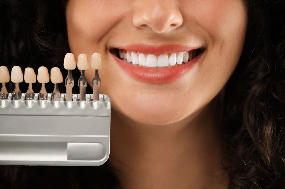 Why 3D Scanned Crowns Offer Superior Gum Line Margins